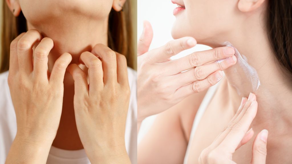 Bôi lớp mỏng và đều đặn giúp thuốc thấm tốt và ít tác dụng phụ