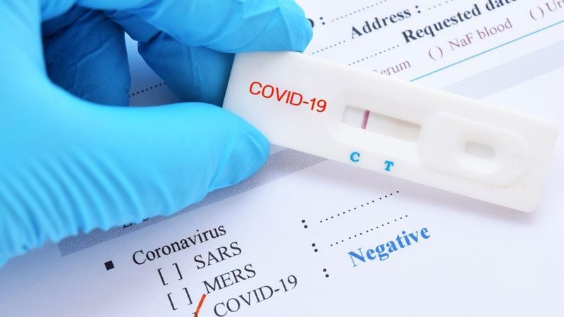 Test nhanh covid 19