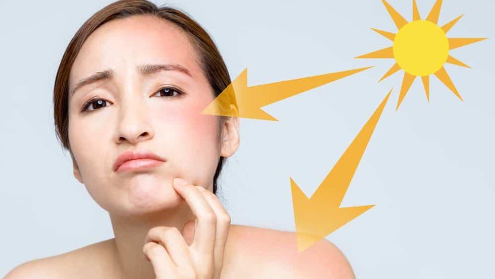 Tia cực tím (UV) là tác nhân trực tiếp phá hủy cấu trúc da và kích thích tăng sắc tố