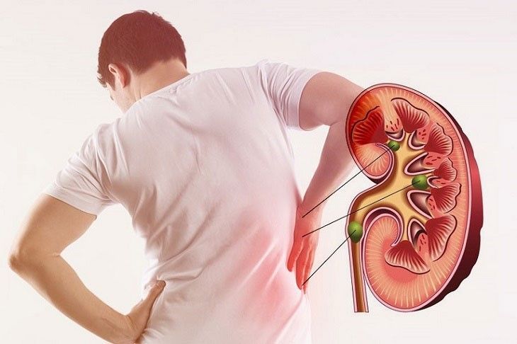 Thân rễ cây mía dò chứa nhiều diosgenin hỗ trợ kháng viêm hiệu quả