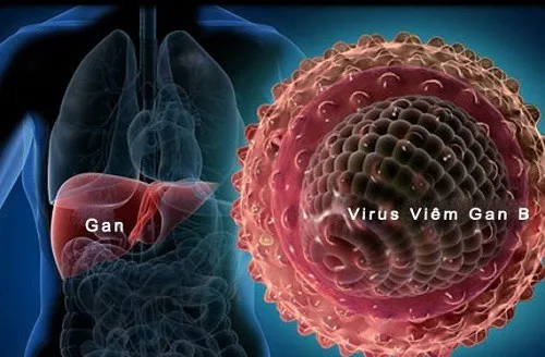 Hiểu rõ về bệnh lý giúp giải đáp thắc mắc viêm gan B có phải đi nghĩa vụ không