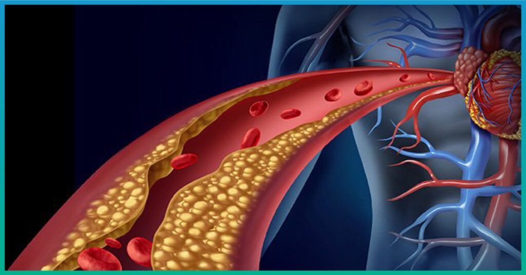 Chế độ ăn nhiều rau quả và thực phẩm tươi giúp mạch máu phục hồi và duy trì sự thông suốt - Chăm sóc và phòng ngừa