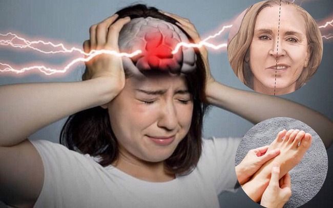 Phim chụp CT sọ não giúp xác định vị trí và kích thước khối xuất huyết