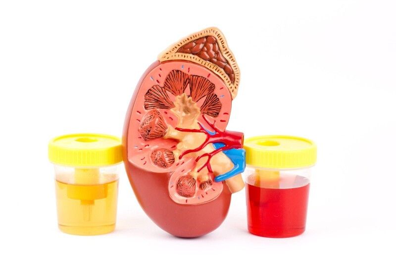 Xét nghiệm chức năng thận thường bao gồm xét nghiệm máu và nước tiểu