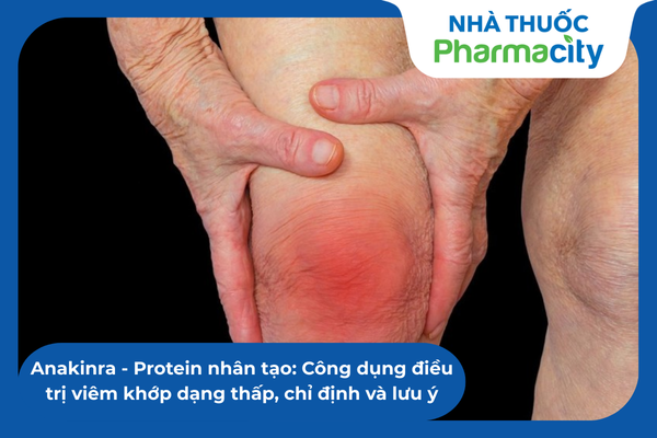 Anakinra - Protein nhân tạo: Công dụng điều trị viêm khớp dạng thấp và ...