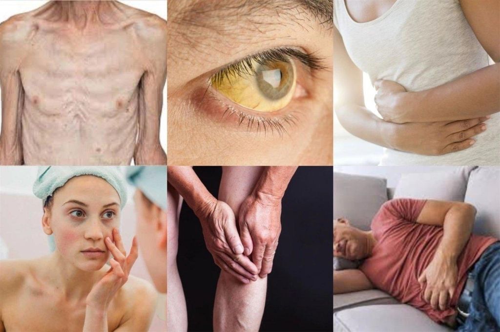Tuân thủ an toàn quan hệ tình dục giúp tránh khỏi nguy cơ lây nhiễm cao