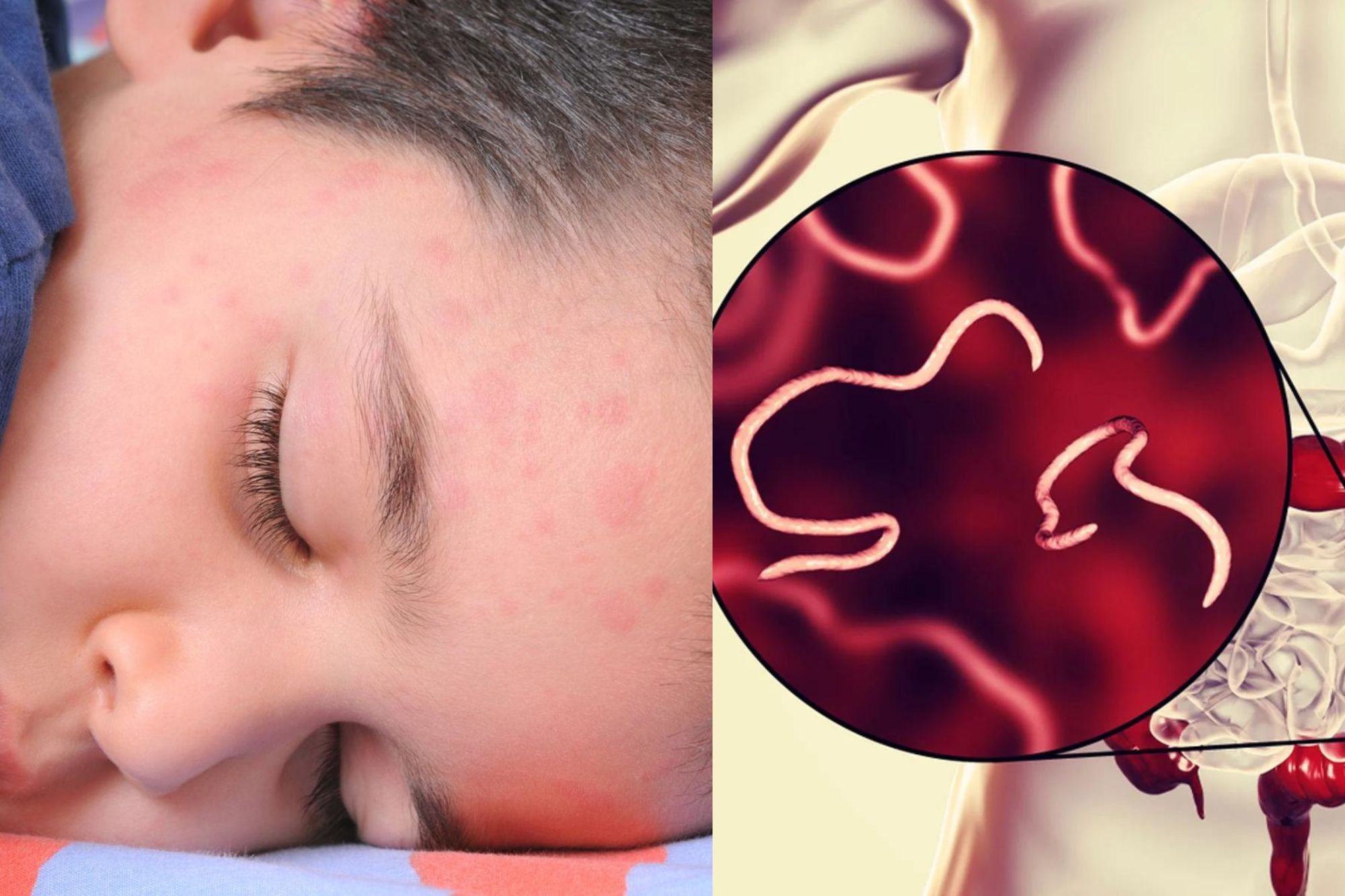 Một số bệnh lý gan và thận có thể gây ngứa râm ran khắp người không nổi mẩn