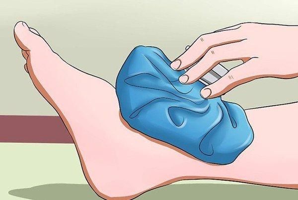 Hình ảnh minh họa các phương pháp xử lý lật cổ chân như nghỉ ngơi, chườm lạnh, băng ép và nâng cao chân