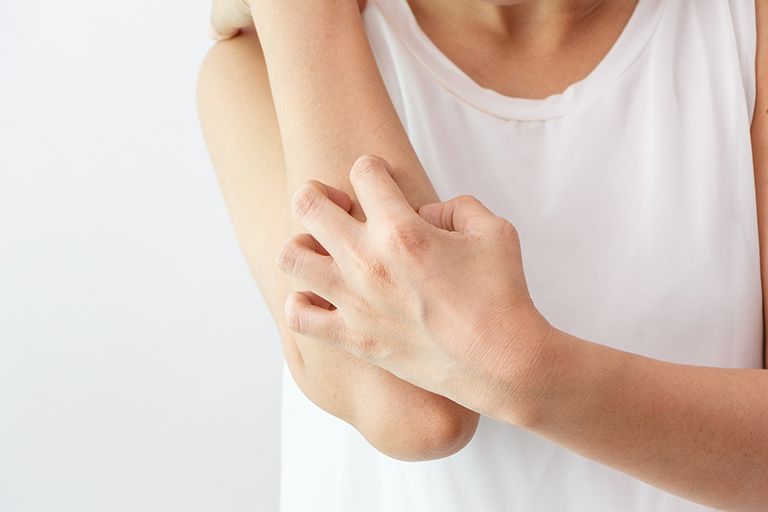 Một số người có thể nổi da gà khi trải qua cảm xúc mạnh hoặc khi nghe nhạc