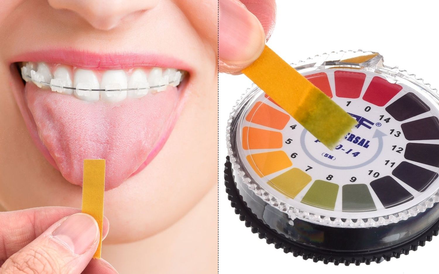 Việc theo dõi pH tại nhà có thể thực hiện bằng que thử nhanh theo hướng dẫn của chuyên gia 
