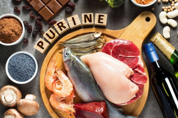 Lựa chọn thực phẩm ít purin là chìa khóa để chung sống hòa bình với bệnh gút 
