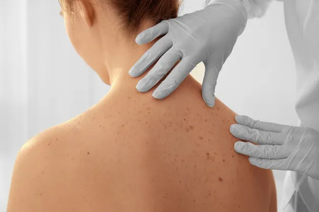 Việc lựa chọn phương pháp điều trị phụ thuộc vào giai đoạn và loại tế bào ung thư 