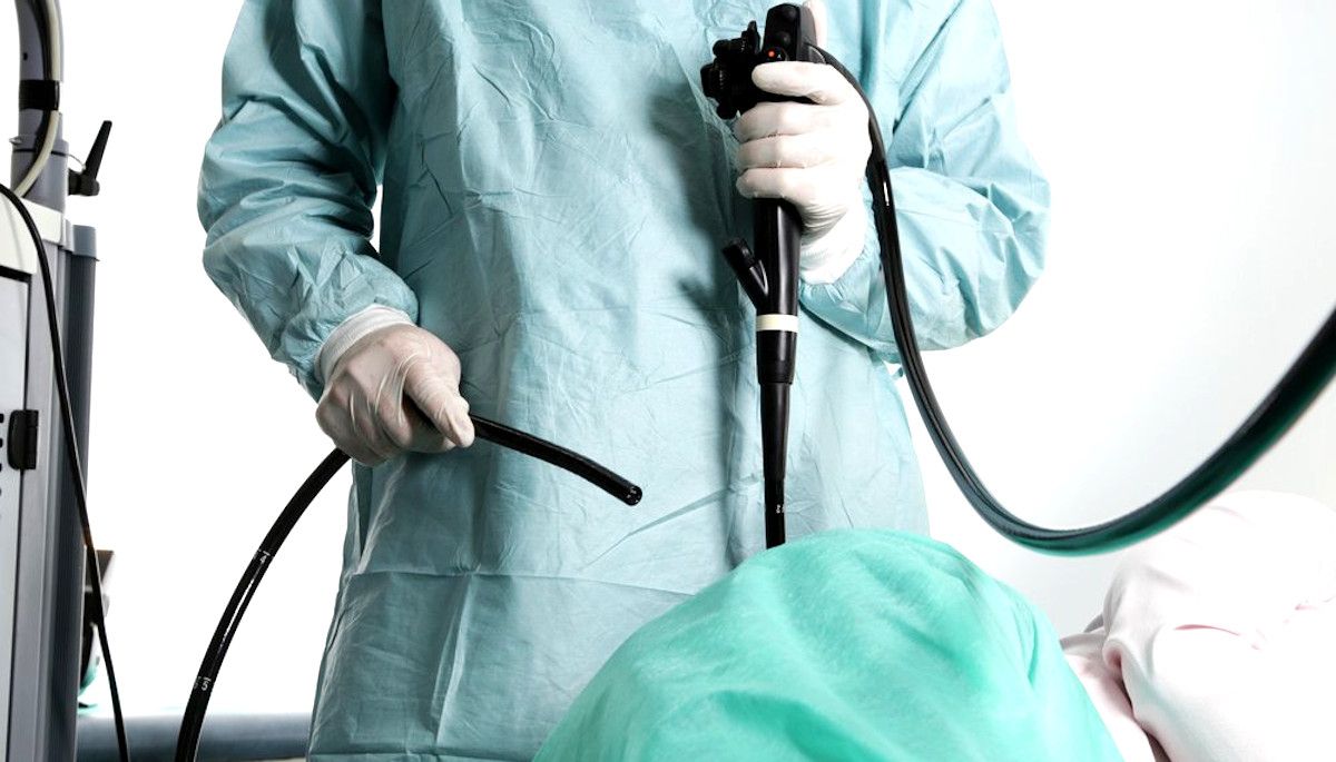 Thực hiện nội soi đại tràng định kỳ là biện pháp chủ động nhất để ngăn ngừa nguy cơ ung thư 