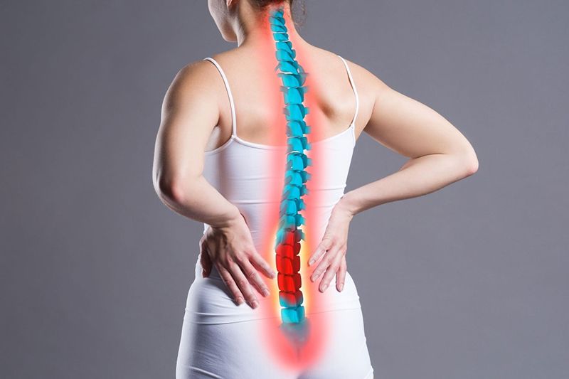 Thoát vị đĩa đệm là nguyên nhân hàng đầu gây chèn ép dây thần kinh tọa 