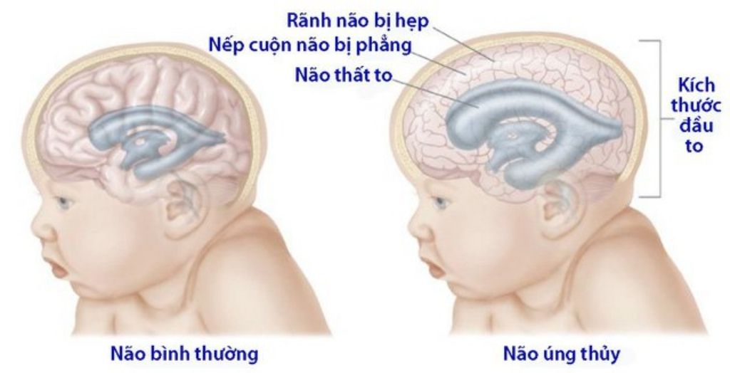 Bệnh viện Sản Nhi Vĩnh Phúc là cơ sở y tế chuyên khoa hạng II uy tín tại địa phương 