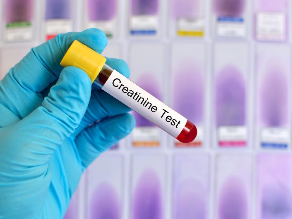 Creatinin là chỉ số quan trọng giúp đánh giá chức năng thận