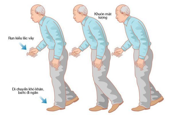 Tiên lượng sống của bệnh nhân phụ thuộc rất nhiều vào khả năng đáp ứng điều trị và nghị lực của bản thân 