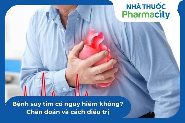 Bệnh suy tim có nguy hiểm không? Chẩn đoán và cách điều trị