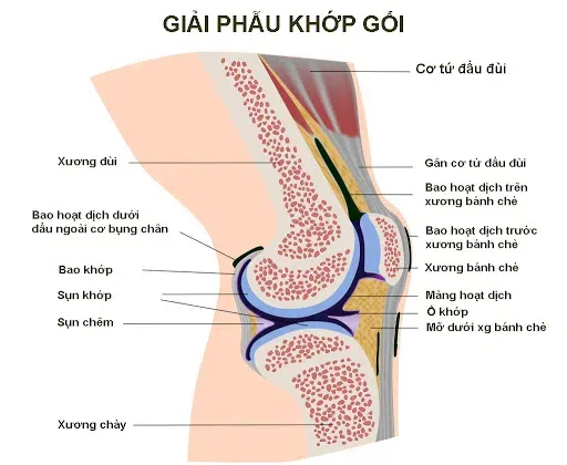 Minh họa về tình trạng cứng khớp do viêm khớp gây ra