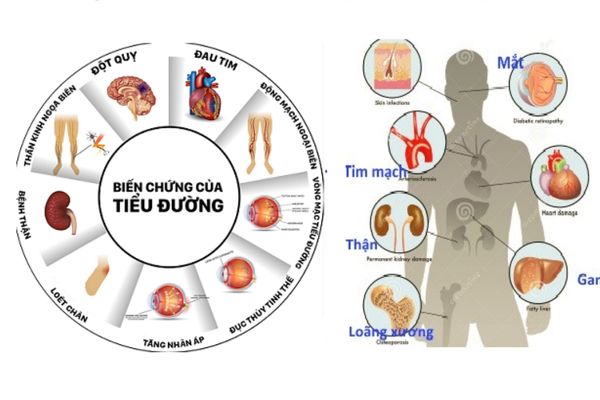Kiểm tra đường huyết thường xuyên giúp đánh giá hiệu quả điều trị