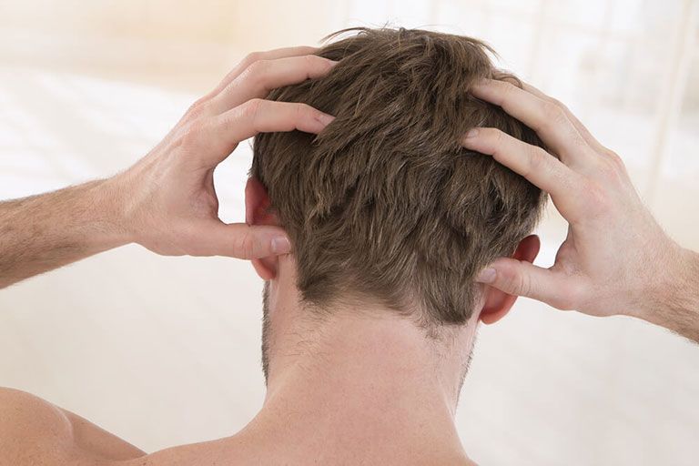 Mụn trên da đầu có thể hình thành khi nang tóc bị tắc nghẽn bởi dầu và bụi bẩn