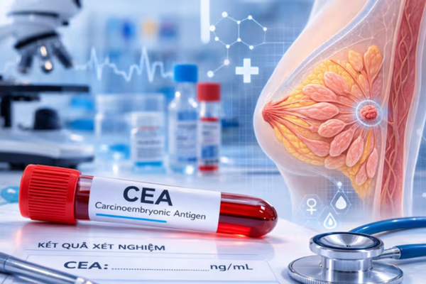 Nồng độ CEA huyết tương vượt trên 10 ng/mL là dấu hiệu nguy hiểm định hướng mạnh đến bệnh lý ác tính 
