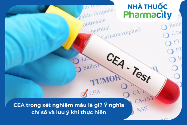 Theo dõi sát sao động học của chỉ số CEA trong các lần thử máu định kỳ giúp phát hiện sớm tín hiệu tái phát 