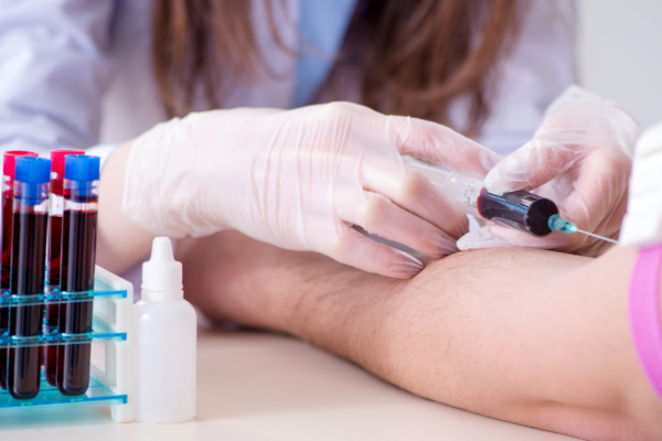 Xét nghiệm chức năng gan là phương pháp phân tích máu để đánh giá sức khỏe tổng thể của gan