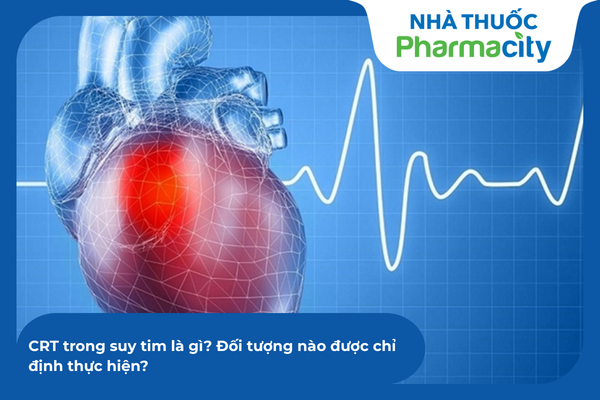 CRT trong suy tim là gì? Đối tượng nào được chỉ định thực hiện?