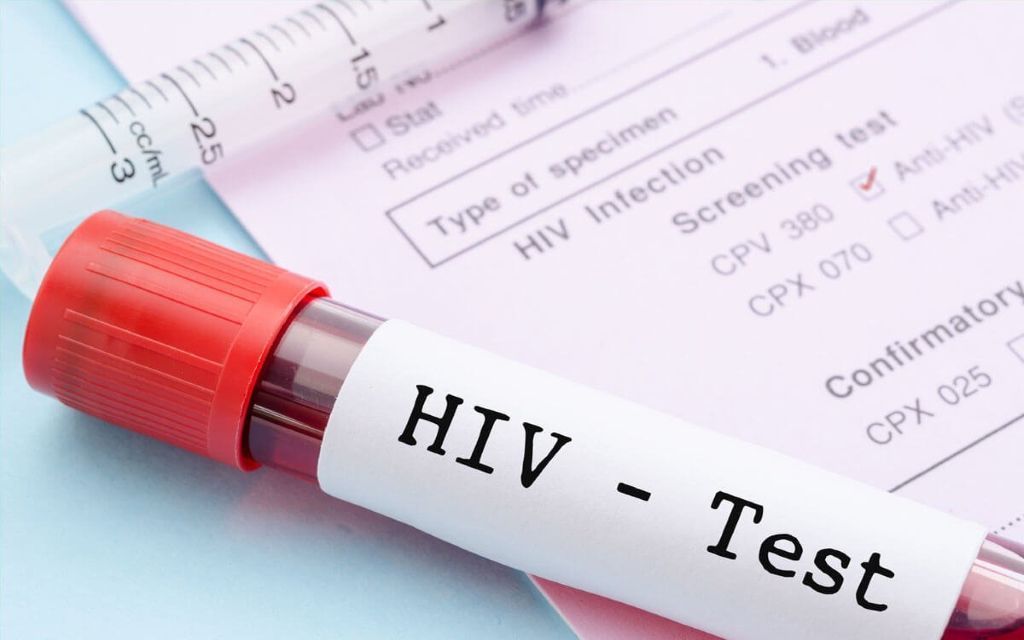 Chi phí xét nghiệm HIV phụ thuộc rất nhiều vào công nghệ và dịch vụ bạn lựa chọn 