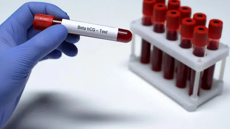 Sự tương quan giữa chỉ số hCG và kết quả siêu âm giúp bác sĩ theo dõi sát sao thai kỳ