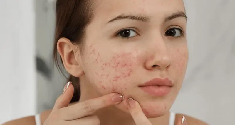 Việc khám sàng lọc kỹ lưỡng trước khi thủ thuật cấy que tránh thai là bước không thể thiếu để loại trừ các rủi ro