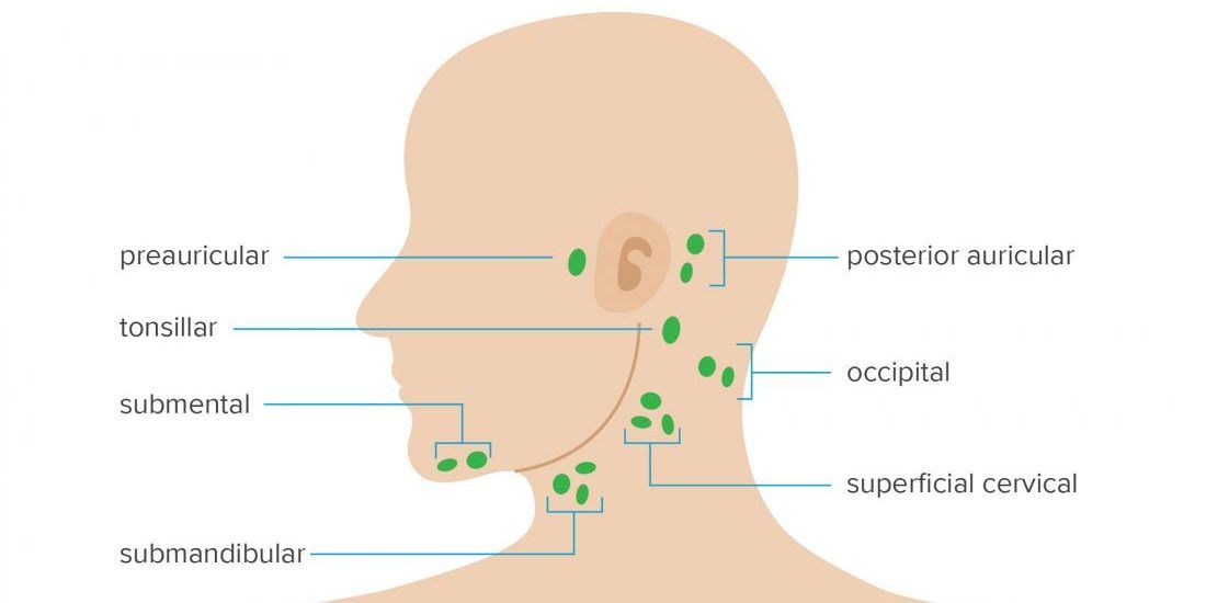U nang bã nhờn có thể tạo thành khối nhỏ dưới da ở vùng sau tai