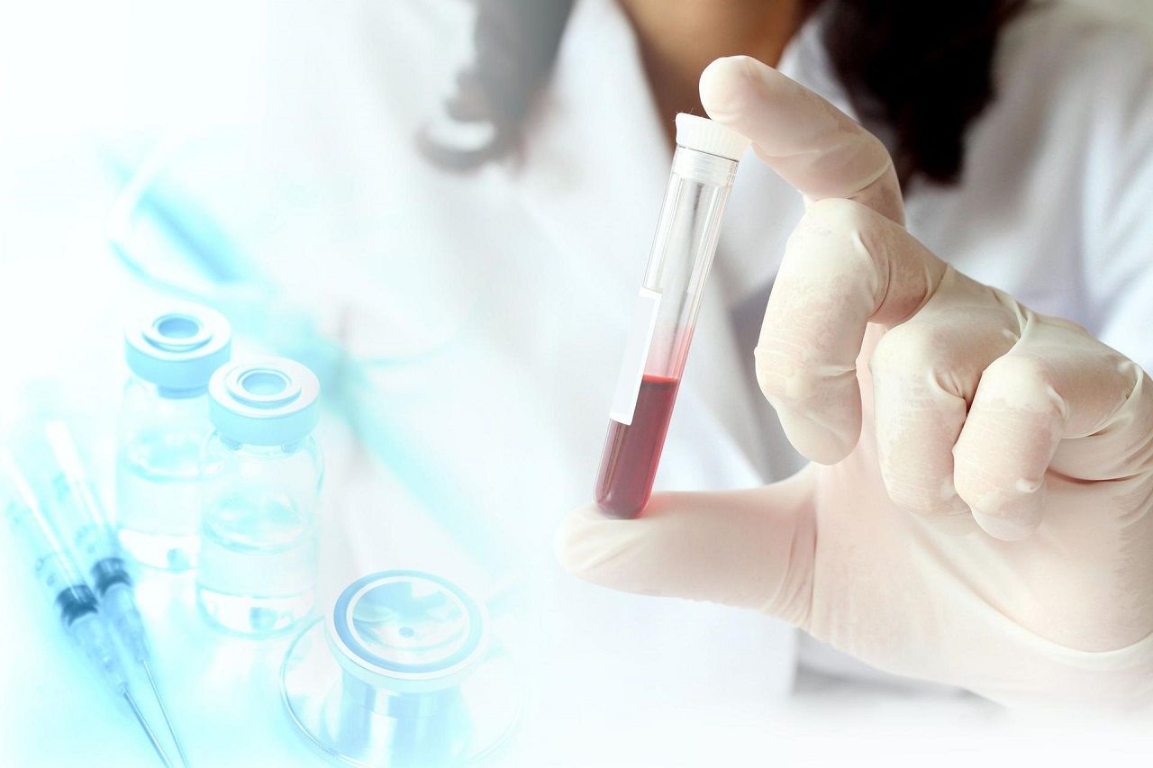 Xét nghiệm chức năng gan giúp đánh giá hoạt động của gan thông qua các chỉ số trong máu