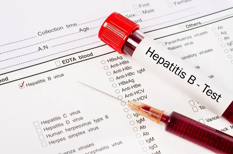 Đun sôi dụng cụ ở nhiệt độ cao là một phương pháp hỗ trợ tiêu diệt virus