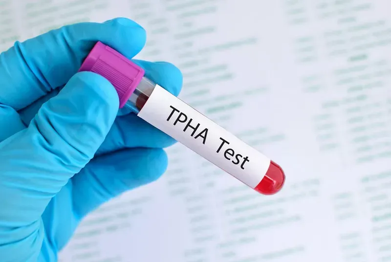 Tpha Bio Rex Xét nghiệm rpr và tpha: phương pháp chẩn đoán giang mai