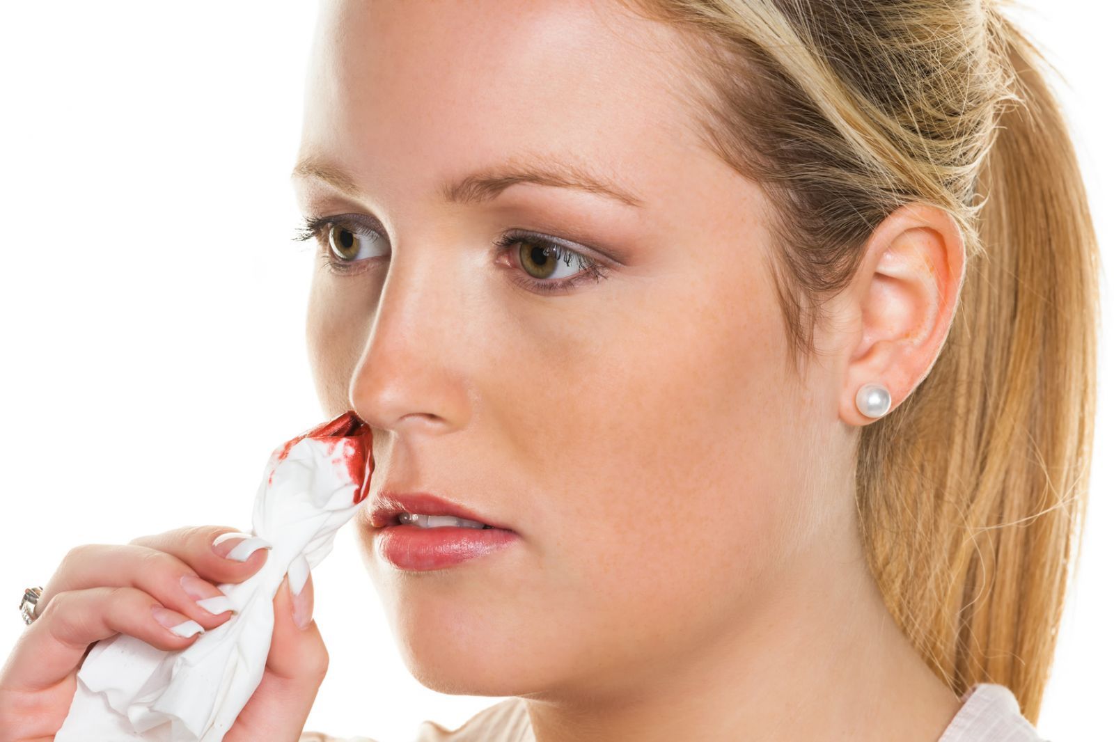 Dấu hiệu bệnh máu trắng cần chú ý 