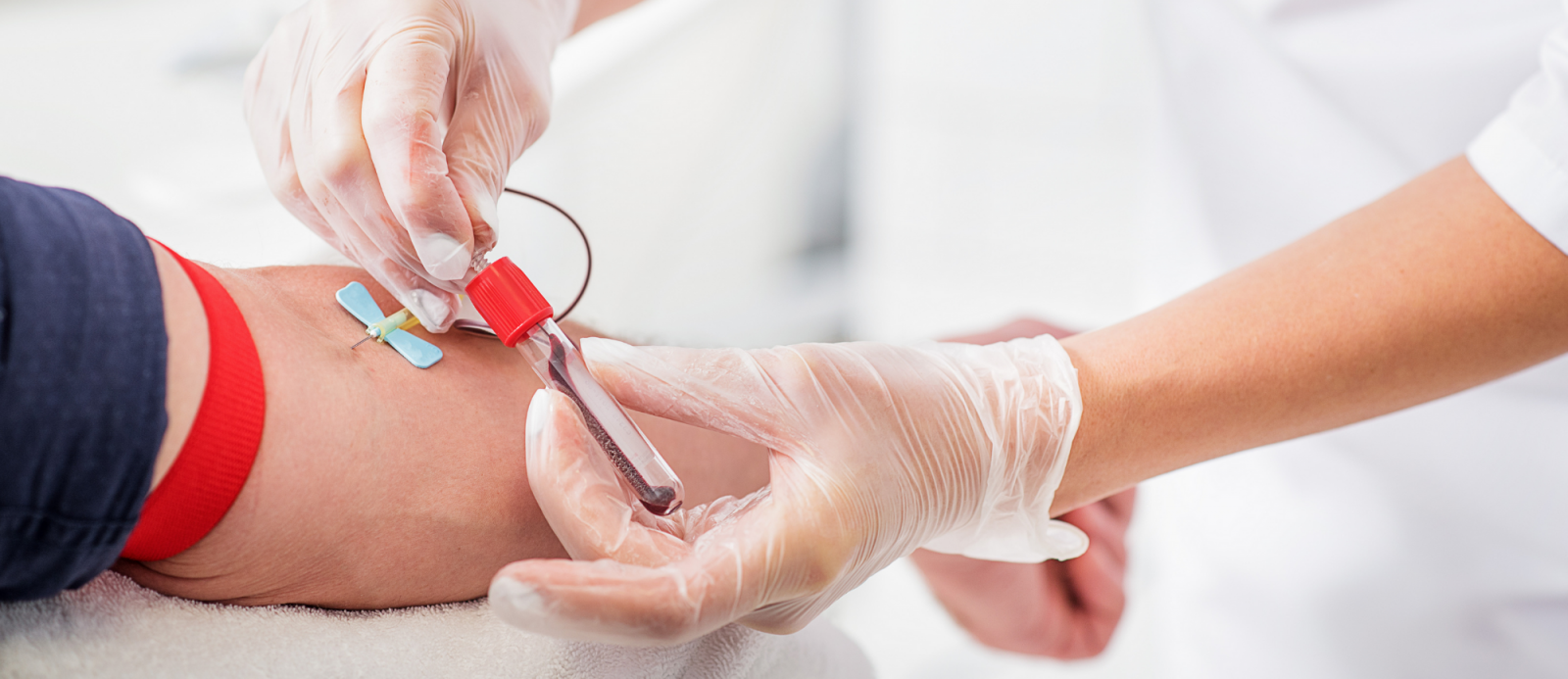 Hình minh họa xét nghiệm HbA1c