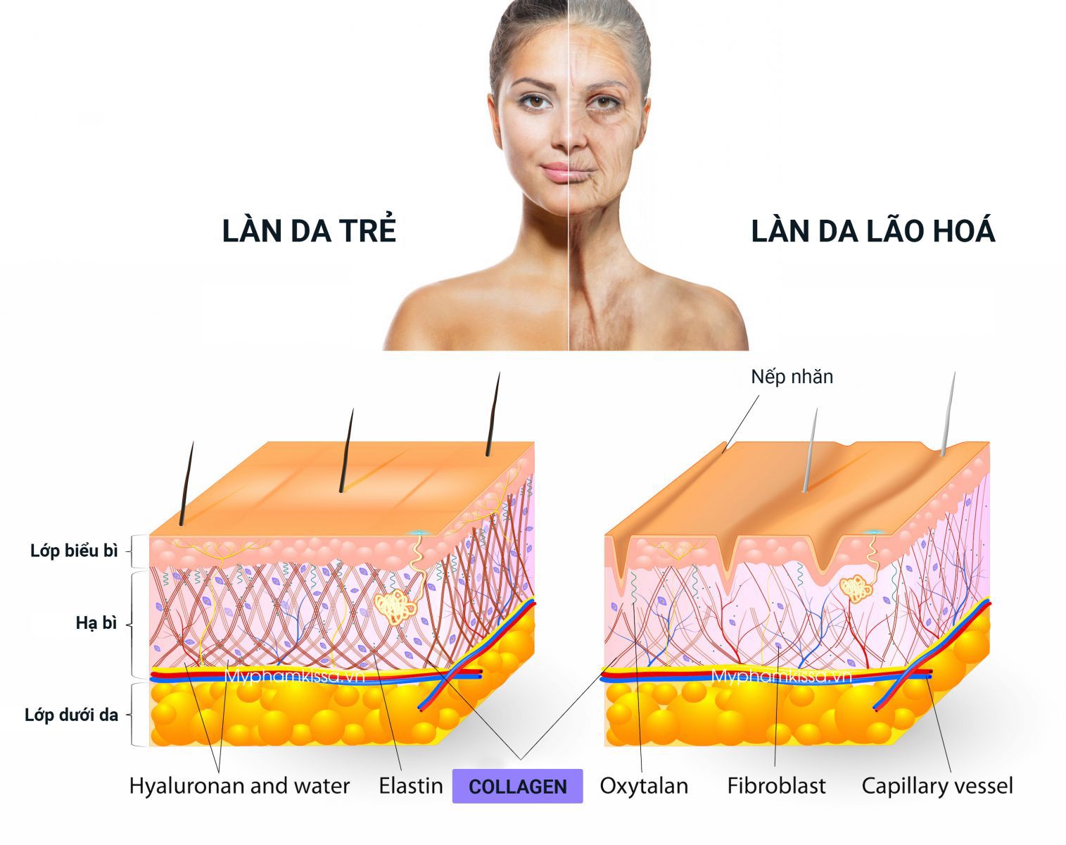 Hình ảnh minh họa vai trò của collagen trong cấu trúc da và mô liên kết. 