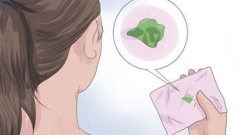 Khí hư màu xanh thường là dấu hiệu của tình trạng nhiễm trùng phụ khoa 