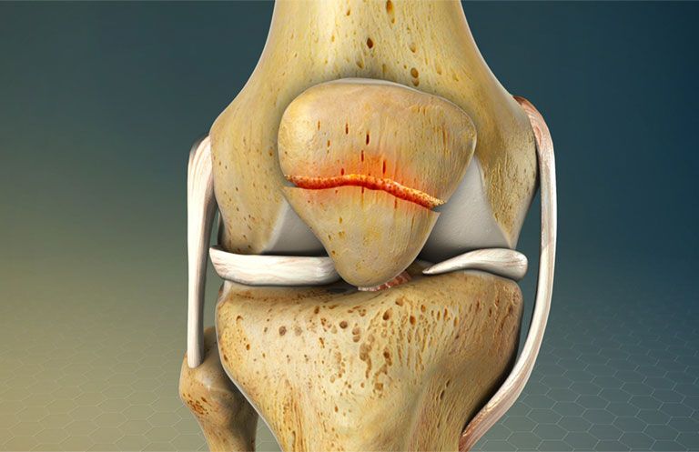 Cấu tạo của xương bánh chè và sự liên kết với các cấu trúc trong khớp gối