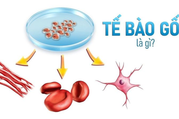Ghép tế bào gốc là một phương thức điều trị ung thư hiện đại 