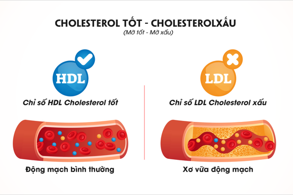 Chỉ số Cholesterol HDL và LDL