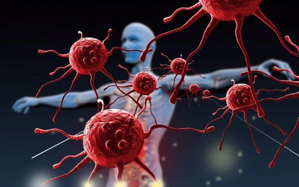 HIV – căn bệnh thế kỷ