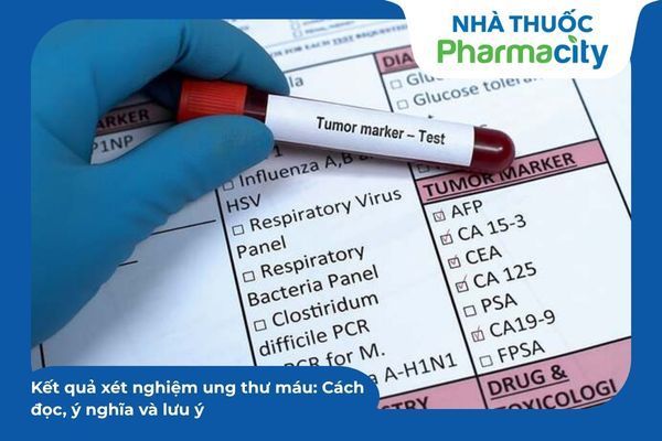 Khi chỉ số CEA tăng nhẹ, người bệnh cần thực hiện nội soi đại trực tràng để tìm chính xác nguyên nhân tổn thương 