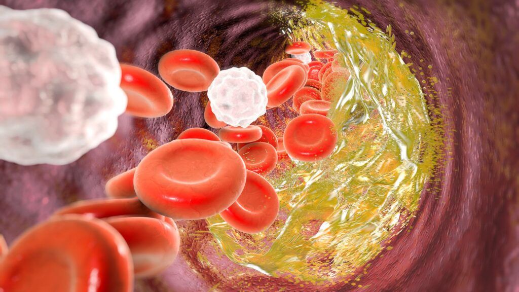 Hình minh họa Cholesterol trong máu ( Nguồn: Sưu tầm )