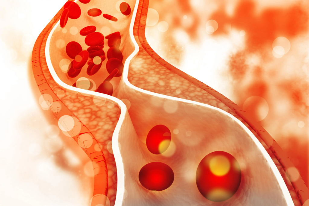 Duy trì lối sống lành mạnh để giúp ích cho các chỉ số cholesterol trong cơ thể