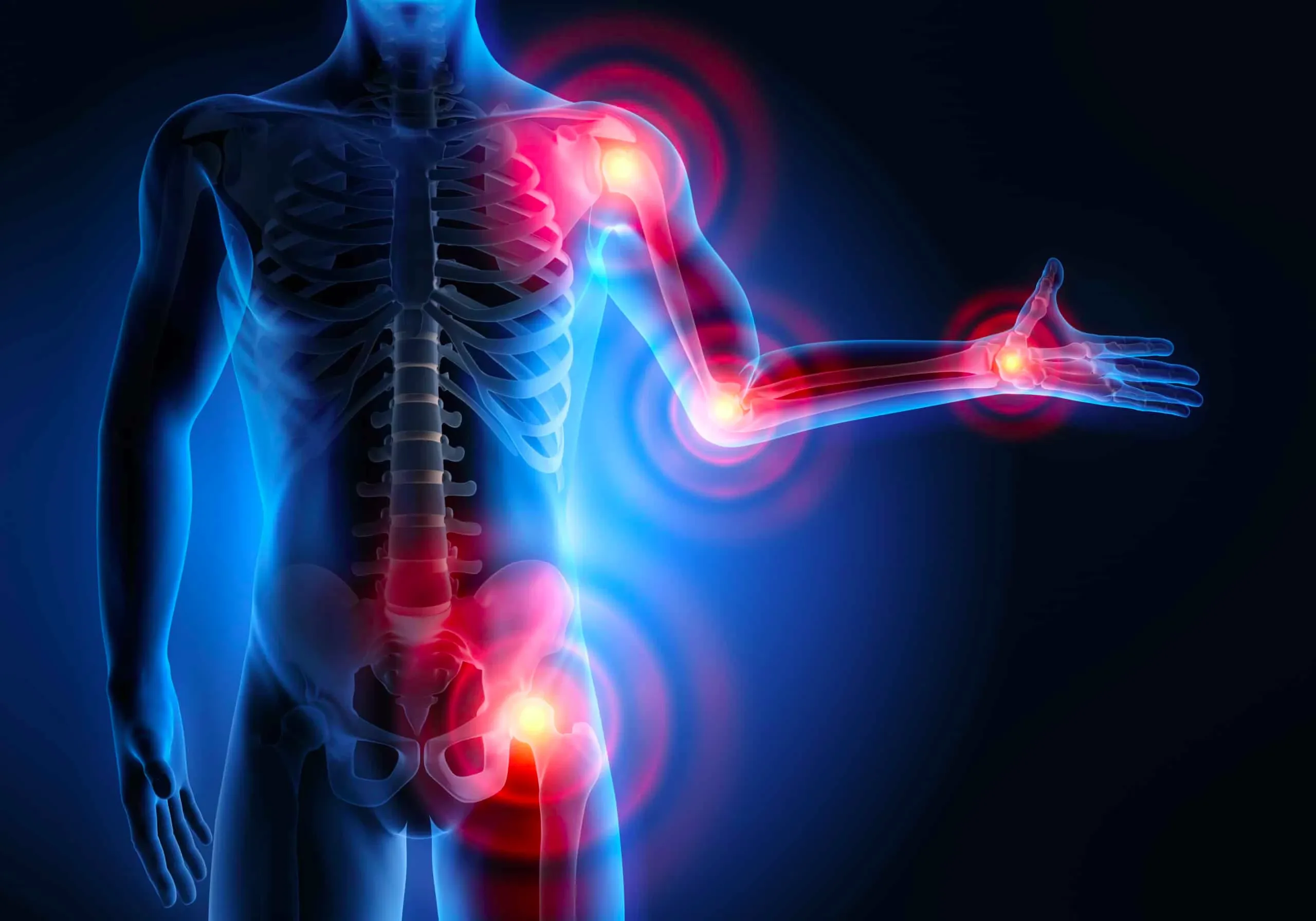 Đau khớp: Dấu hiệu nhận biết sớm và cách phòng bệnh