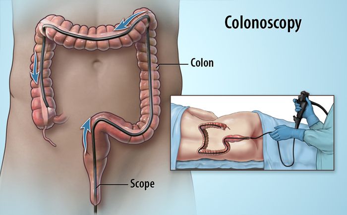 Các kỹ thuật nội soi hiện đại như phóng đại và nhuộm màu giúp bác sĩ quan sát rõ hơn các tổn thương niêm mạc