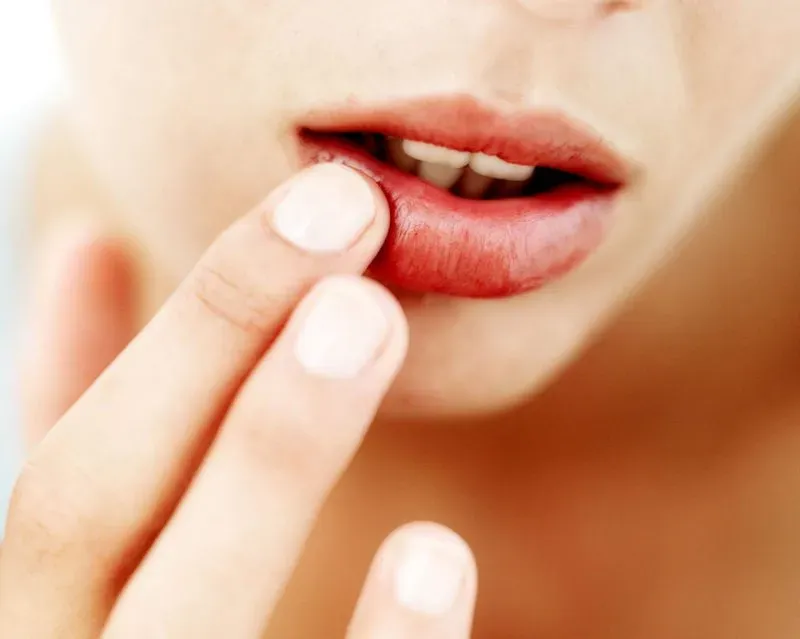 Gel nha đam có thể hỗ trợ làm dịu vùng môi bị kích ứng và sưng nhẹ.